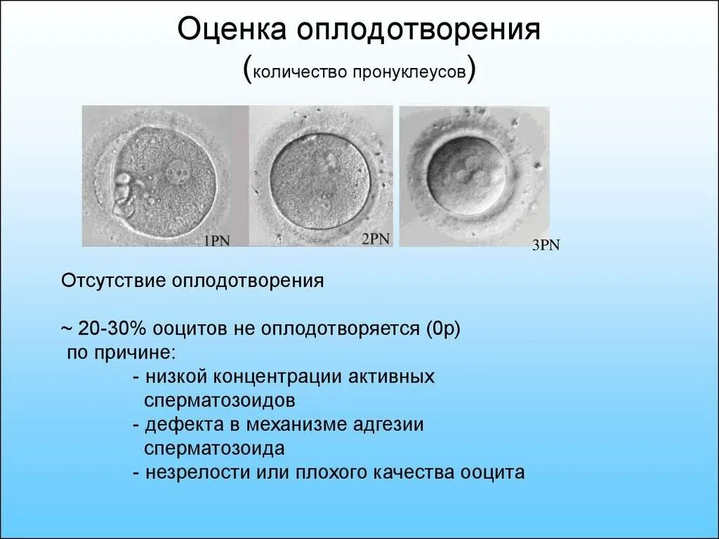 Сколько эмбрионов форум. Оценка оплодотворения. Оценка качества ооцитов. Оценка оплодотворения ооцитов. Плохое качество яйцеклеток.