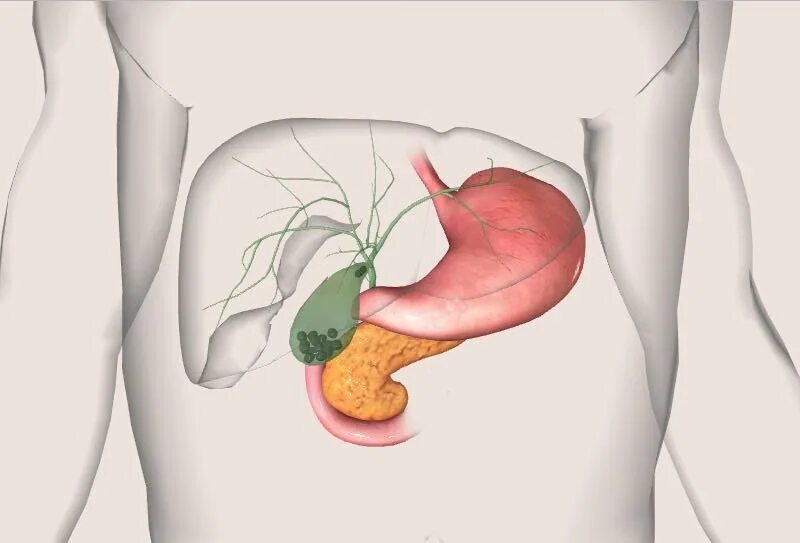 Как жить без желчного пузыря. Gallbladder желчный пузырь. Расположение желчь пузыря. • Калькулёзный холецистит реактивный панкреатит. Атипичное расположение желчного пузыря.