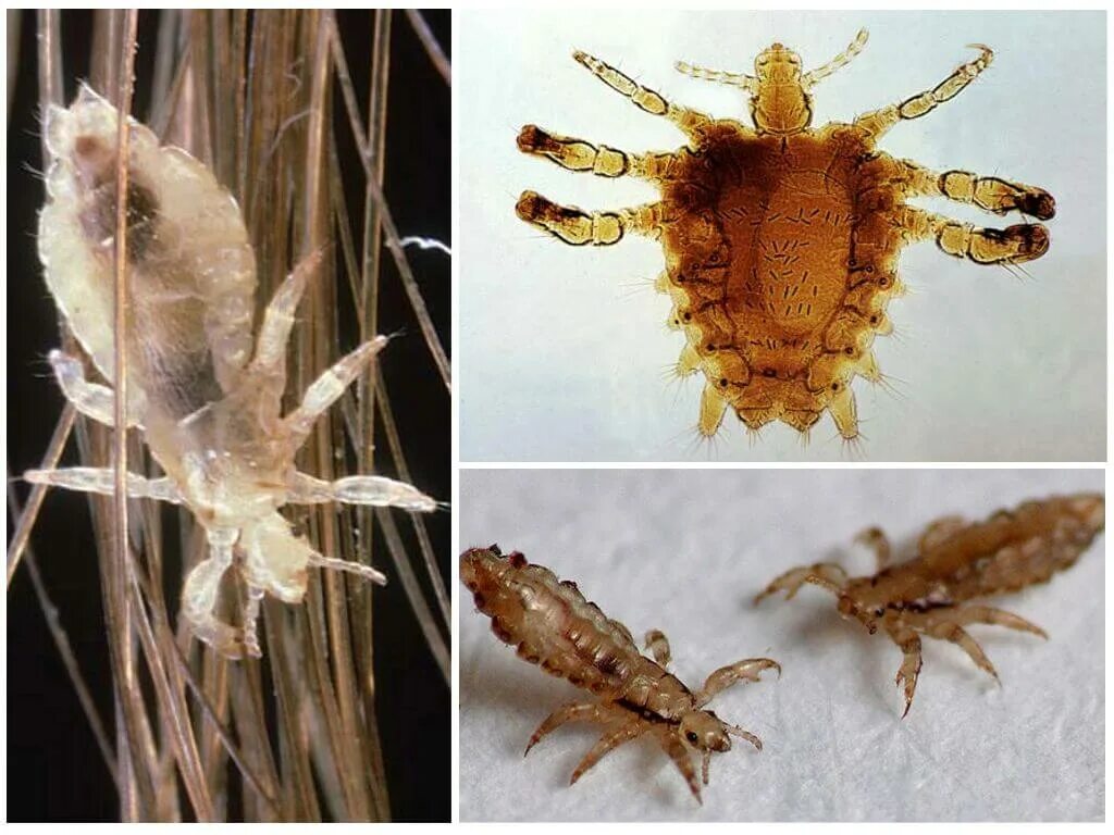 Головная вошь (Pediculus humanus capitis). Платяная вошь (Pediculus humanus corporis). Мандавошки бельевые вши. Гнида головной вши