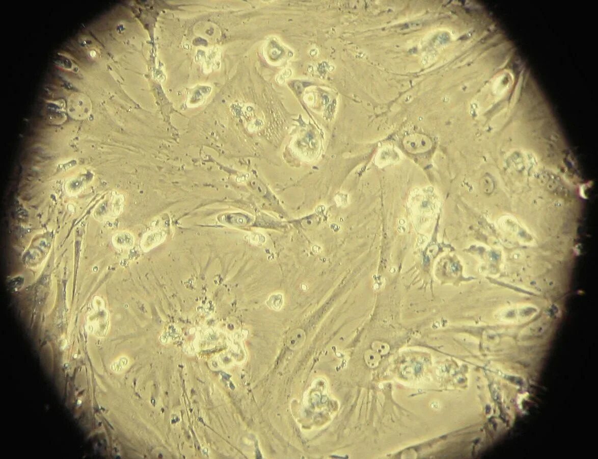 Фетальные стволовые клетки под микроскопом. Эмбриональные стволовые клетки под микроскопом. Стволовая клетка под микроскопом. Эмбриональные стволовые клетки человека под микроскопом.