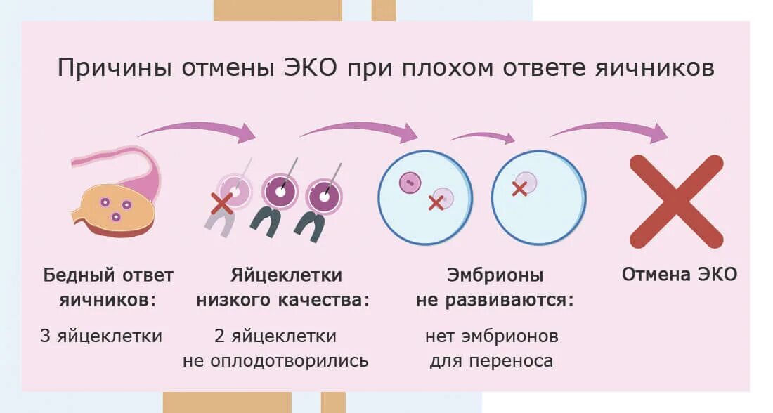 Беременность в естественном цикле. Экстракорпоральное оплодотворение схема. Беременность в естественном цикле. Экстракорпоральное оплодотворение схема. Эко в естественном цикле статистика.