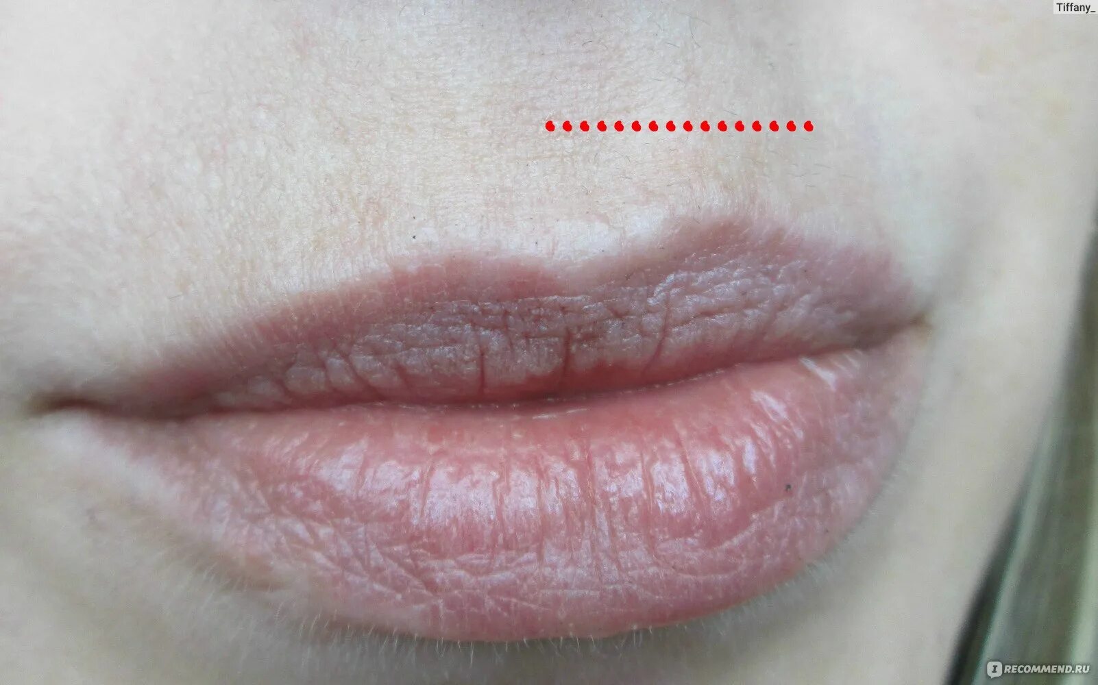 Кисетные морщины над верхней губой. Дергается над губой. Губы зубы при произношении звука л. Люди с большой верхней губой. Волосы над губой у женщин.