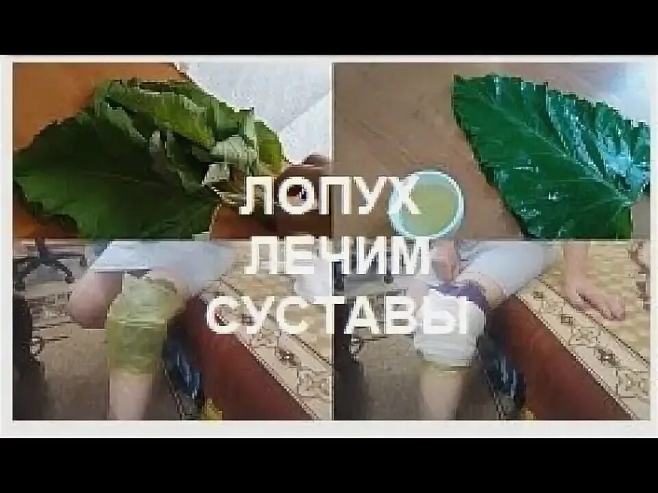 Каким местом прикладывать лопух. Листья лопуха на коленный сустав. Компресс из листьев лопуха. Прикладывание лопуха к суставам. Компрессы с листьями лопуха суставов.