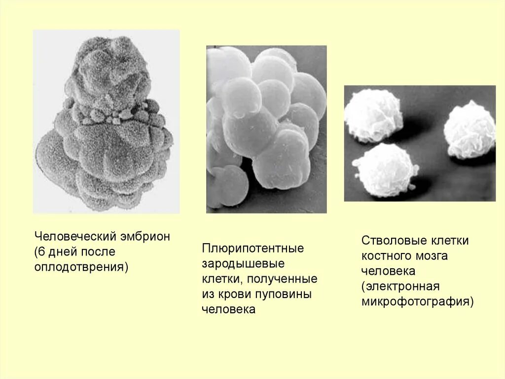Стволовые клетки. Клетки крови развиваются из эмбрионального материала. Эмбриональные клетки. Эмбриональные стволовые клетки получают из.