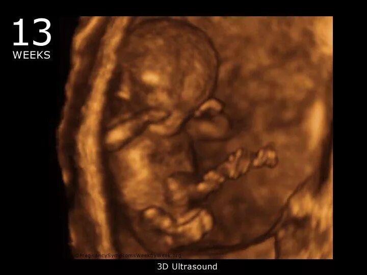 Беременность 13 мм. 13 Недель беременности фото плода на УЗИ. 3д УЗИ на 13 неделе беременности. Эмбрион на 13 неделе фото УЗИ. Снимки УЗИ 13 неделе беременности.