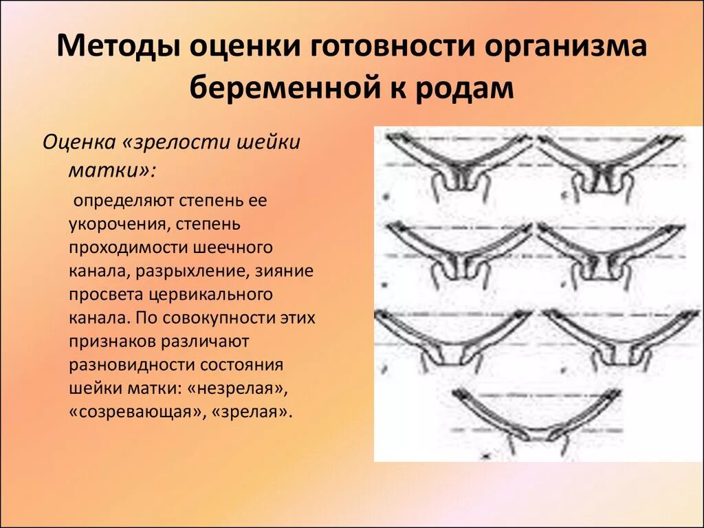 Как понять что готова к родам. Оценка готовности беременной к родам. Методы оценки готовности организма к родам. Методы оценки готовности организма беременной к родам. Критерии готовности к родам.