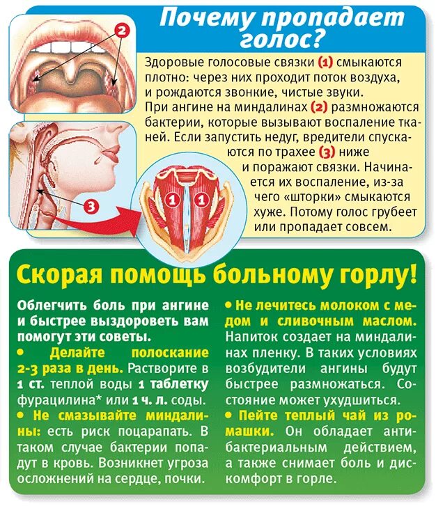 Чем лечить горло взрослому. Ангина у детей ангина симптомы. как быстро вылечить ангину у ребенка.