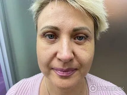 Фрау операция