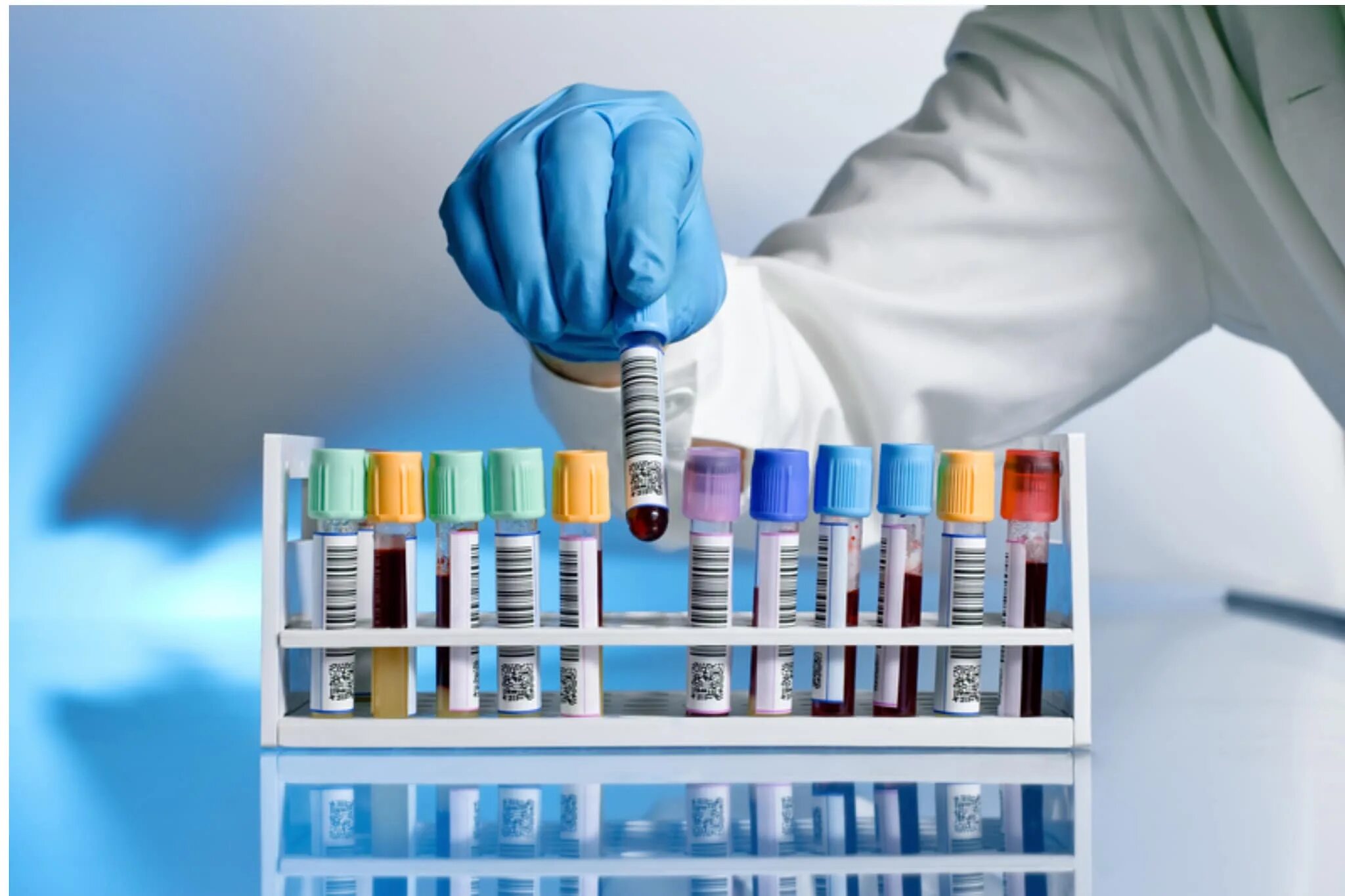Анте анализы. Анте анализы. Анте анализы. Medical tests. Инфекционный мононуклеоз лейкоцитарная формула.
