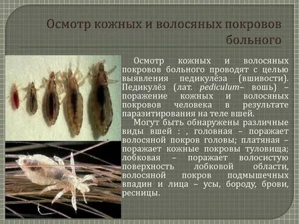 Осмотр на педикулез