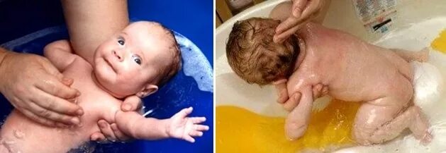 Как правильно держать при подмывании. Купание новорожденного в роддоме. Подмывание малышей грудничков. Для подмывания новорожденных. Купание новорожденного под краном.