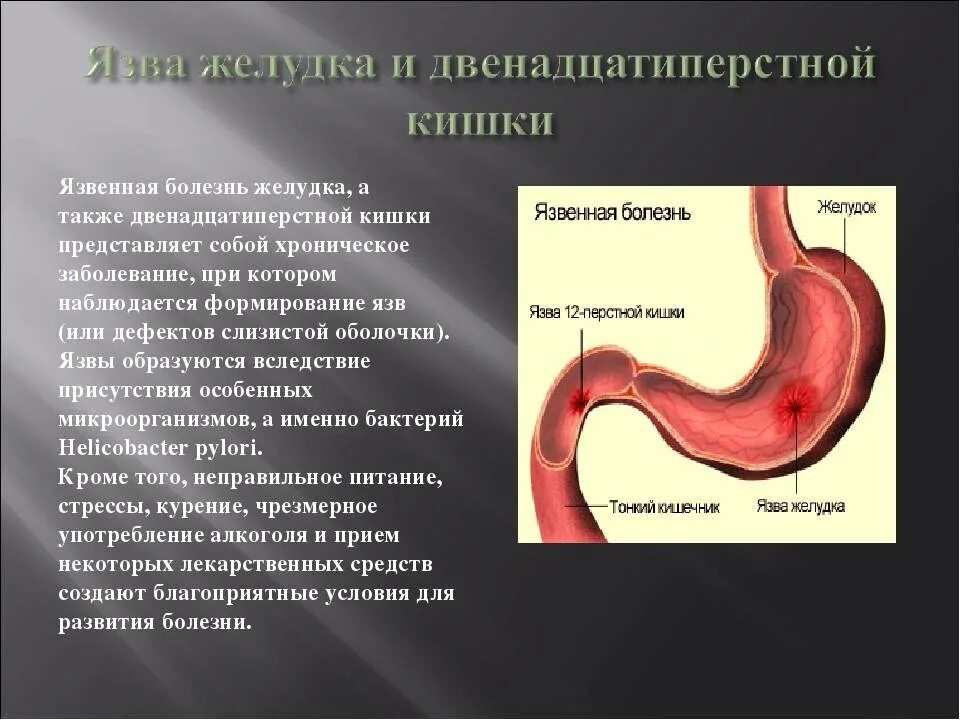 Ябж рекомендации