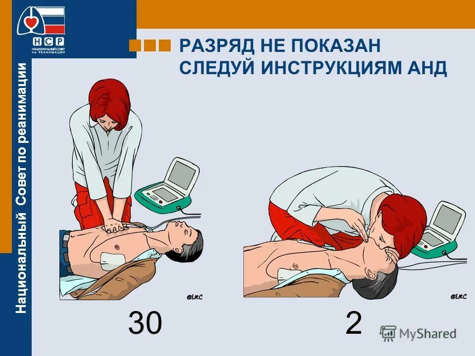 Циклы реанимации. Анд сердечно легочная реанимация. Циклы реанимации. При выполнении мероприятий при сердечно-легочной реанимации:. Этапы первичной сердечно-легочной реанимации схема.
