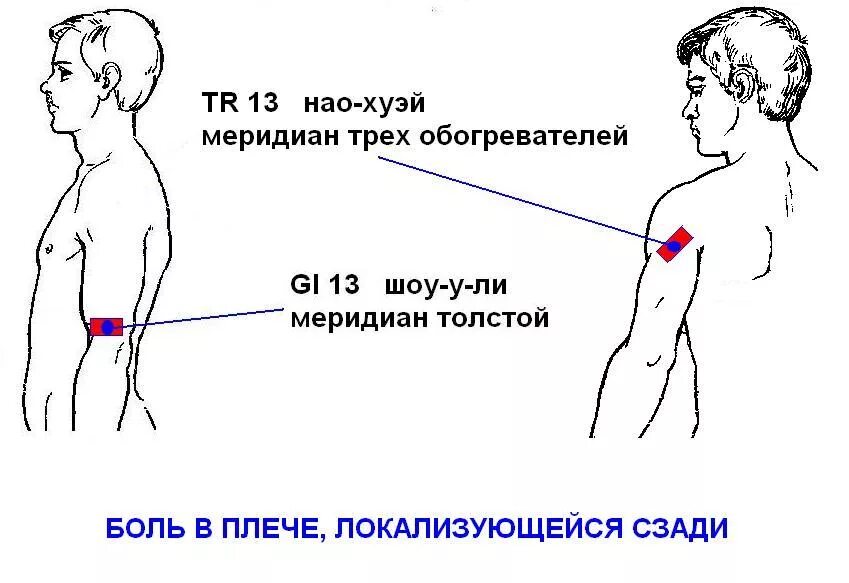 Болит левое плече у мужчины. Точки при боли в плече. Болит левое плечо. Ноющая боль в плече и предплечье.