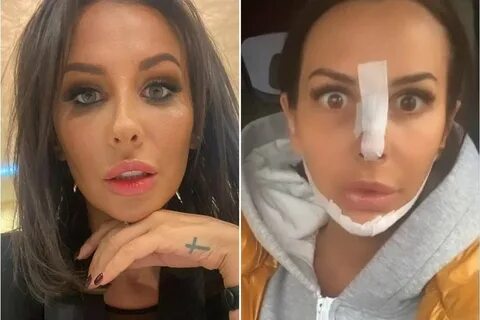 Асти певица до и после пластики