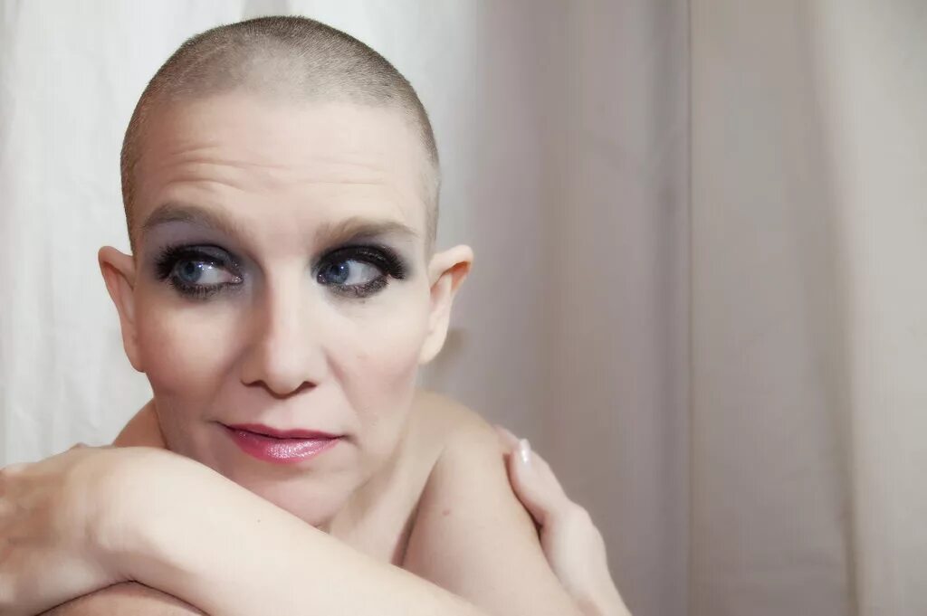 Волосы на голове после химиотерапии. Люди после химиотерапии. Волосы после химиотерапии. Женщина после химиотерапии. В париках после химиотерапии фото.