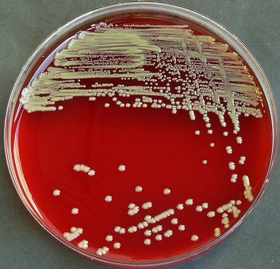 Холера питательные среды. Мелиоидоз возбудитель. Burkholderia Mallei микробиология. Burkholderia Mallei бактерии.