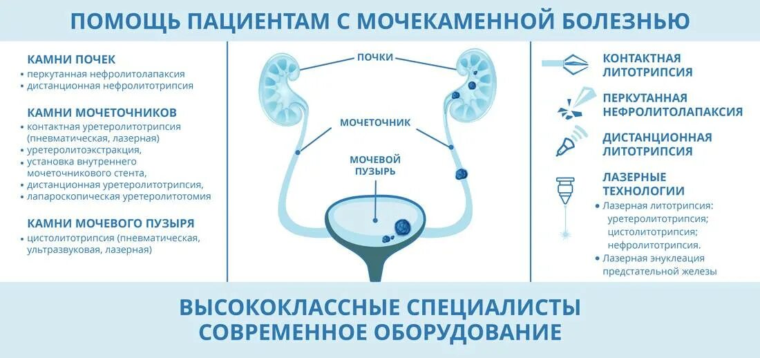 При камнях в почках какую воду пить. Основные клинические проявления мочекаменной болезни. Образование камней при мочекаменной болезни. Мочевыделительная система при мочекаменной болезни. Заболевания мочевыделительной системы мочекаменная болезнь.