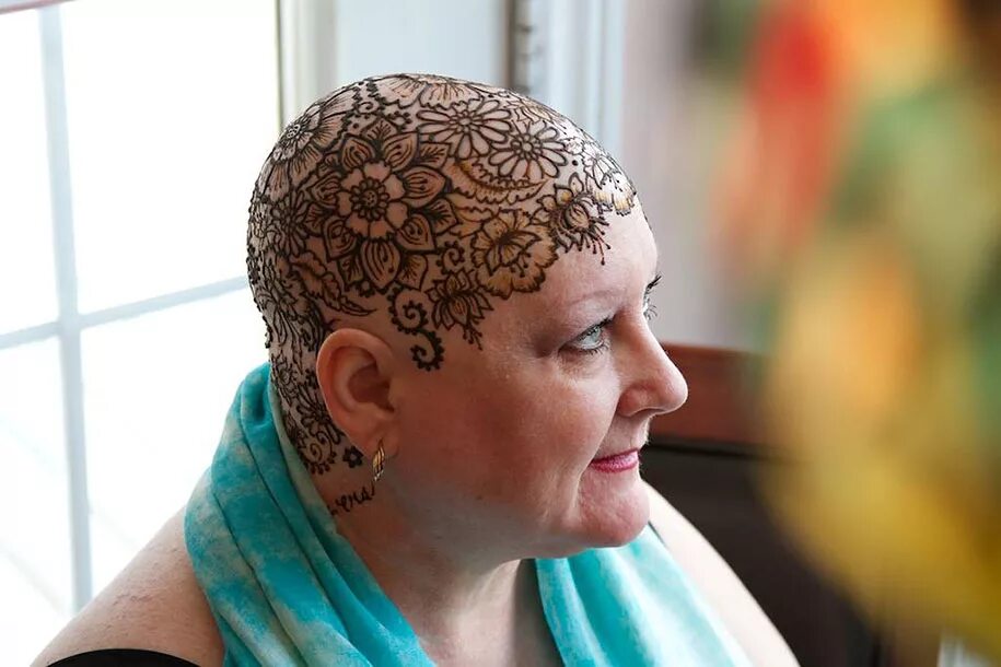 Волосы на голове после химиотерапии. Головные уборы для лысых женщин. Тату на голове. Тату на голову для женщин. Тату на голове у девушки.