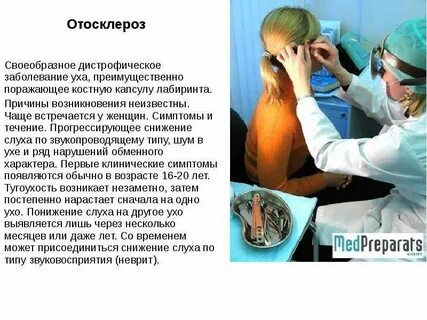 Отосклероз уха