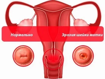 Почему матка красная