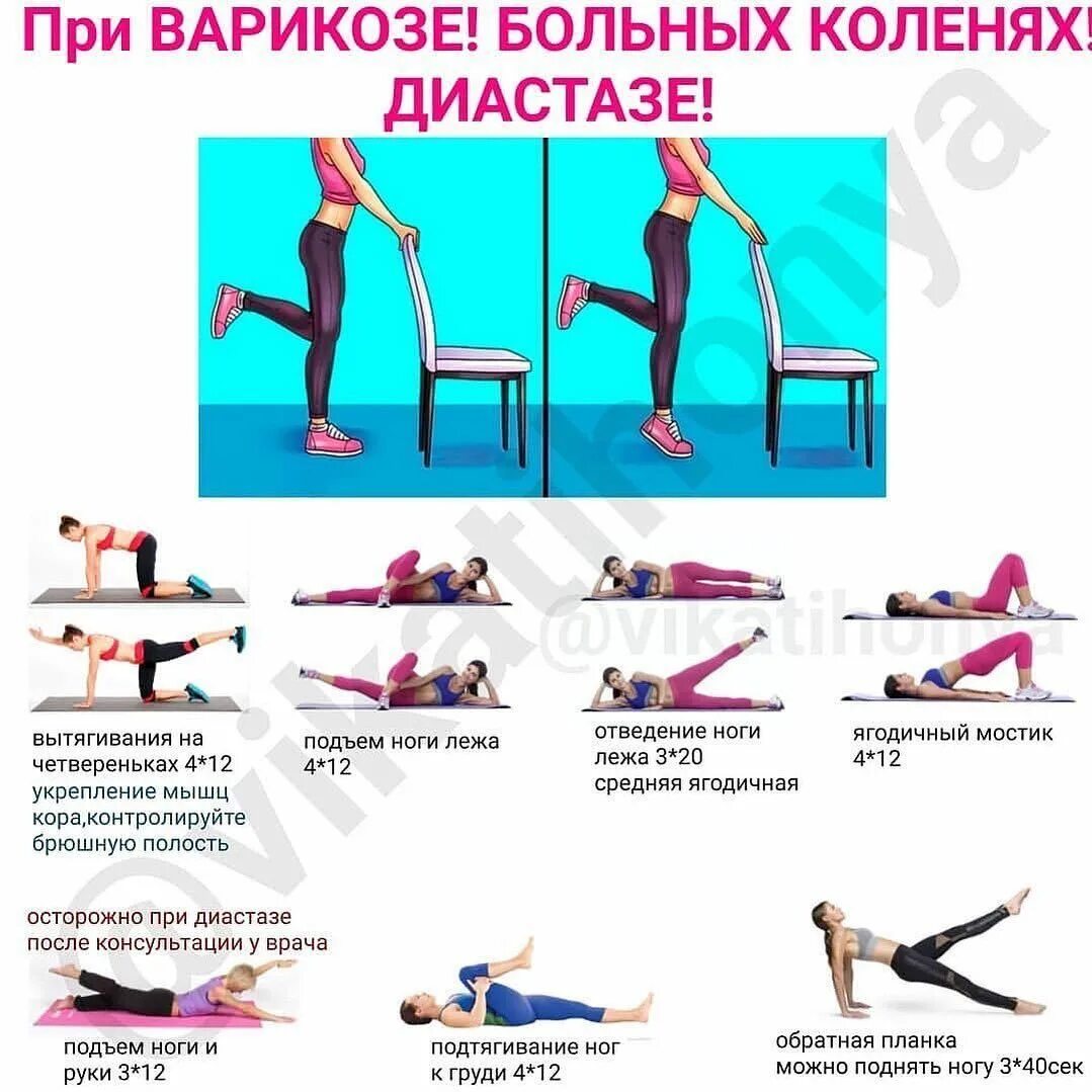 Какие упражнения делают при диастазе. Комплекс упражнений при диастазе. упражнения для пресса при диастазе. упражнения для похудения при диастазе. упражнения для пресса при диастазе прямых мышц.