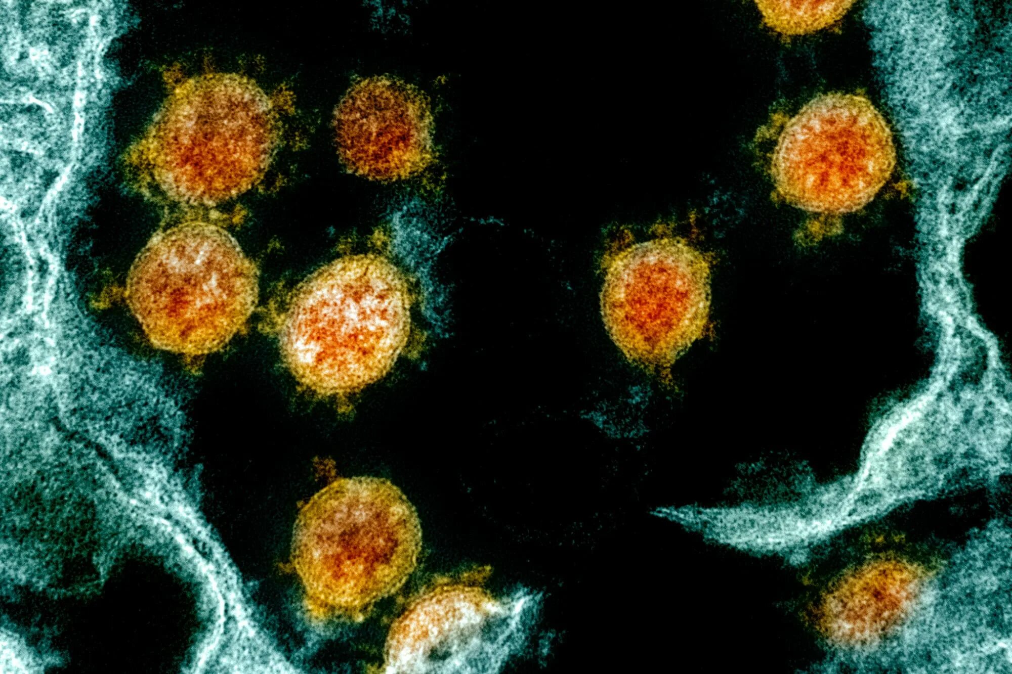 Эволюция вирусов. Молнуправир. Вирус гриппа фото. Коронавирус клетка. Коронавирус фото.