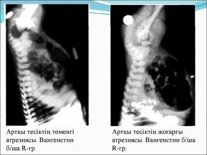 Дикті аяғыңызбен қысыңыз