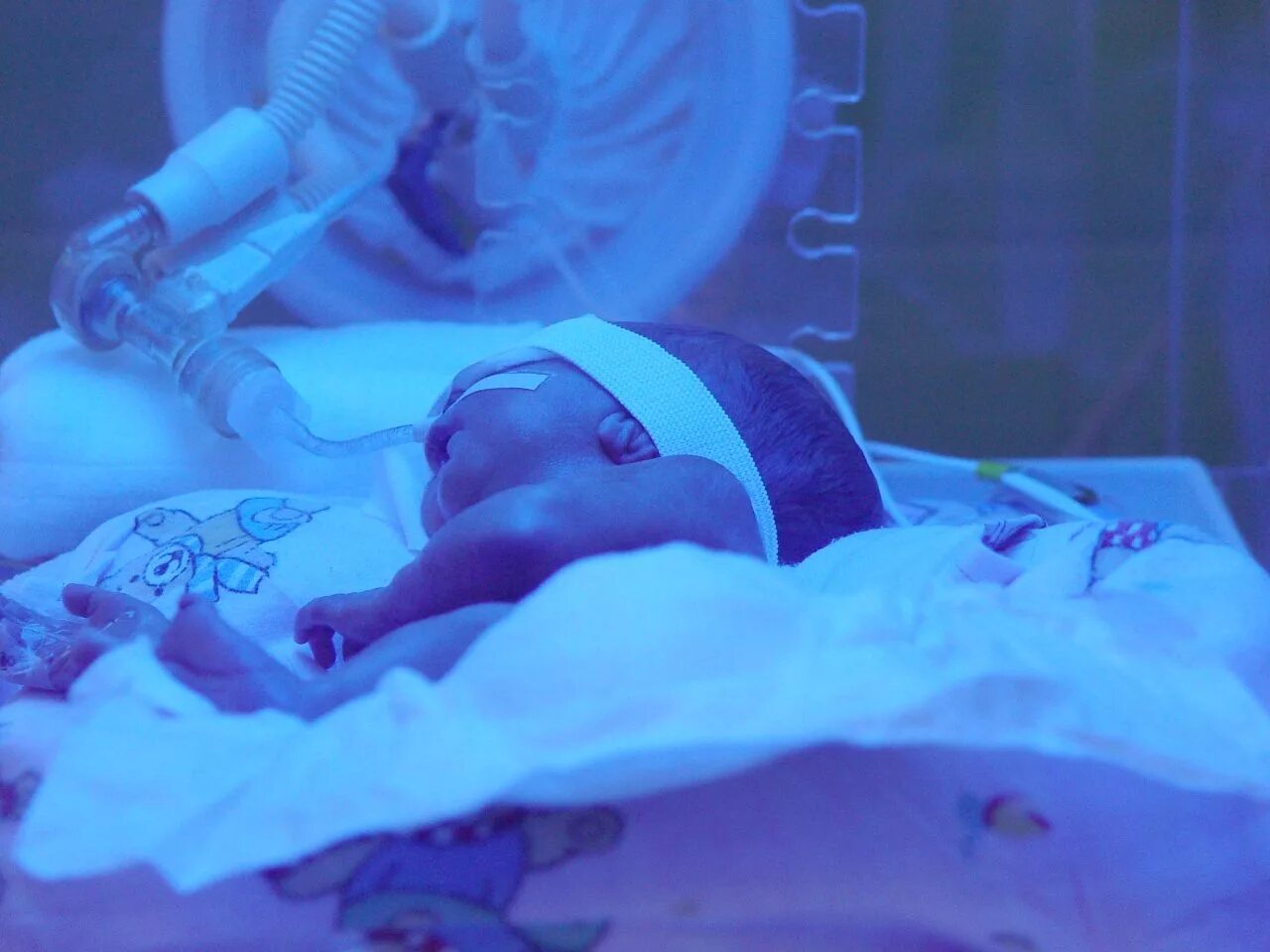 Фото плода после солевого аборта. Дочь рональда обрайна. Stillbirth. Фотосессия с мертвым младенцем. Рожденный быть мертвым.