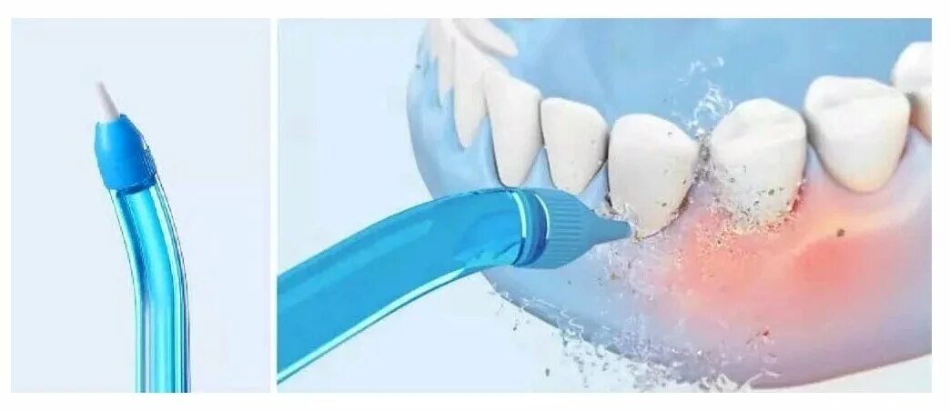 ирригатор mi. ирригатор yunchi. ирригатор для полости рта xiaomi soocas w3. ирригатор mi. ирригатор soocas w3, белый.