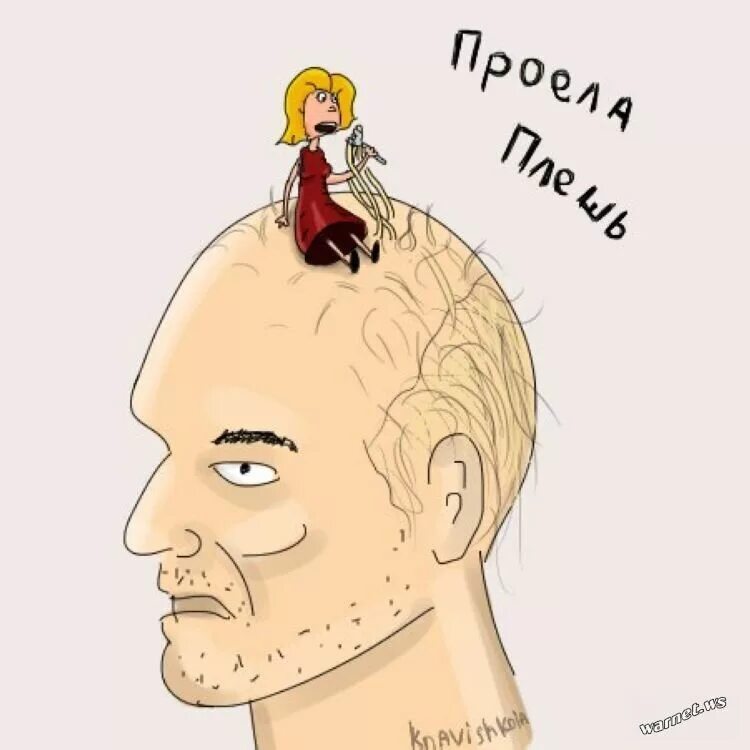 Плешь проем. Плешь на голове у мужчин. Плешь проем. Мужская лысина. Очаговая (гнездная) алопеция.