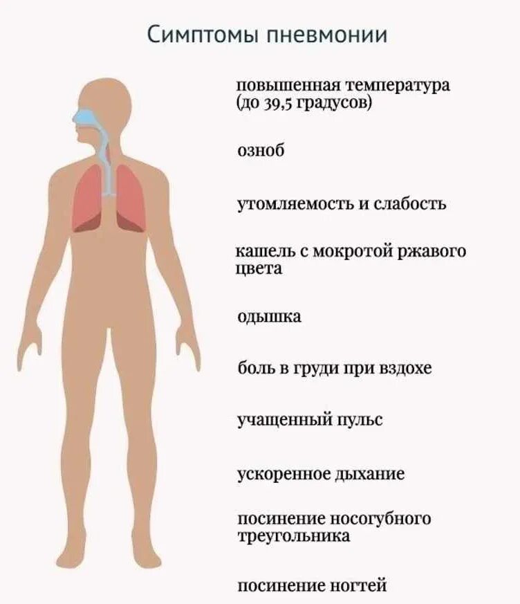 Что такое пневмония легких у взрослых симптомы