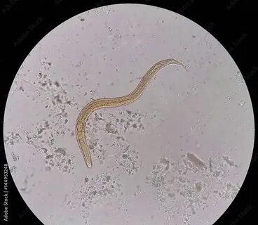 В каком состоянии находится нематода panagrolaimus kolymaensis