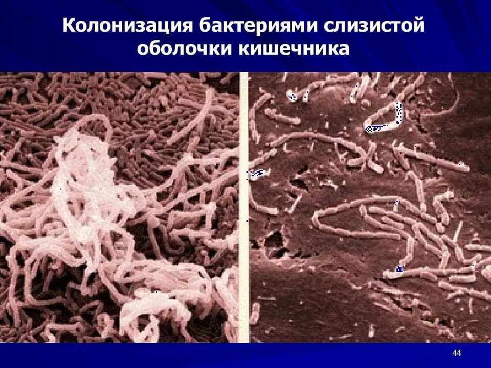 Роль бактерий толстого кишечника человека. Биопленки микроорганизмов. Колонизация бактерий. Микробы в кишечнике.