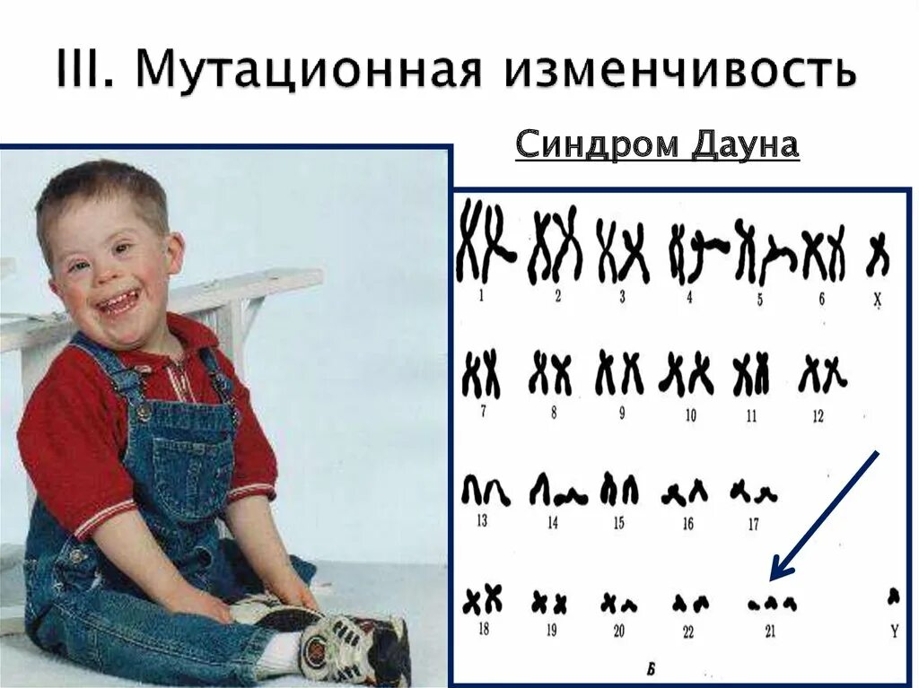 Поведение дауна. Синдром Дауна. Мутационная изменчивость синдром Дауна. Мозаичный вариант синдрома Дауна.