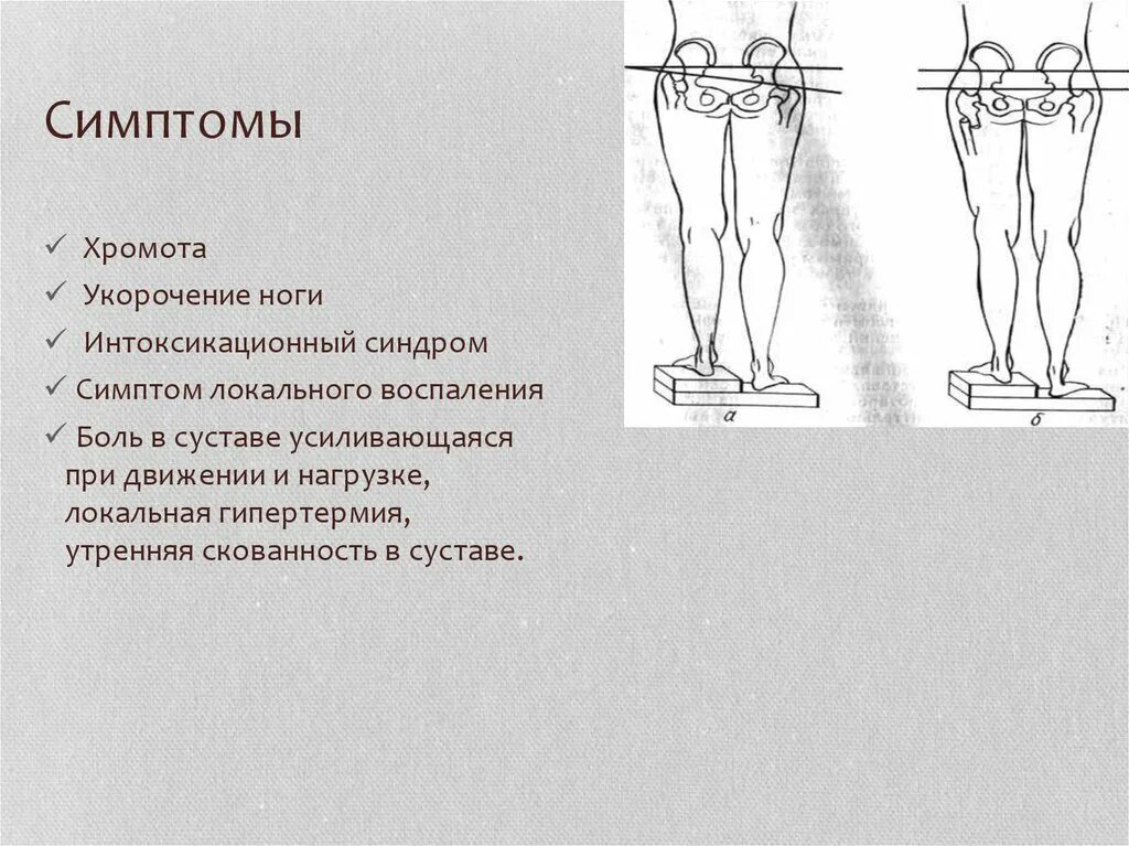 Почему хромает нога. Укорочение конечности. Укорочение ноги причины.