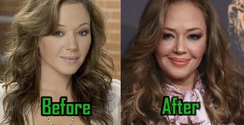 Leah Remini Plastic Surgery: Facelift, Lips Surgery? Before-