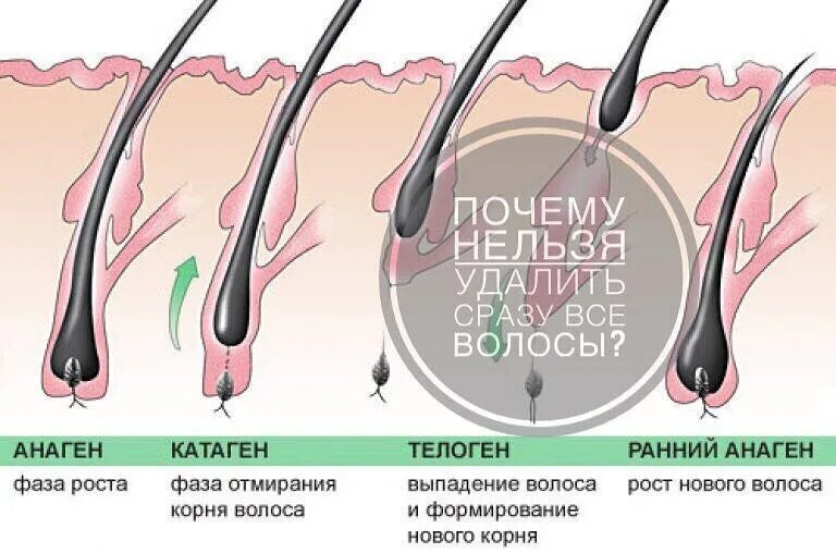 Электроэпиляция бикини. Фотоэпиляция лазерная глубокое бикини. Можно ли делать электроэпиляцию. Электроэпиляция волос на животе. Плакат электроэпиляции.