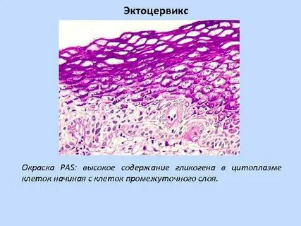 Соскоб эпителия эктоцервикса