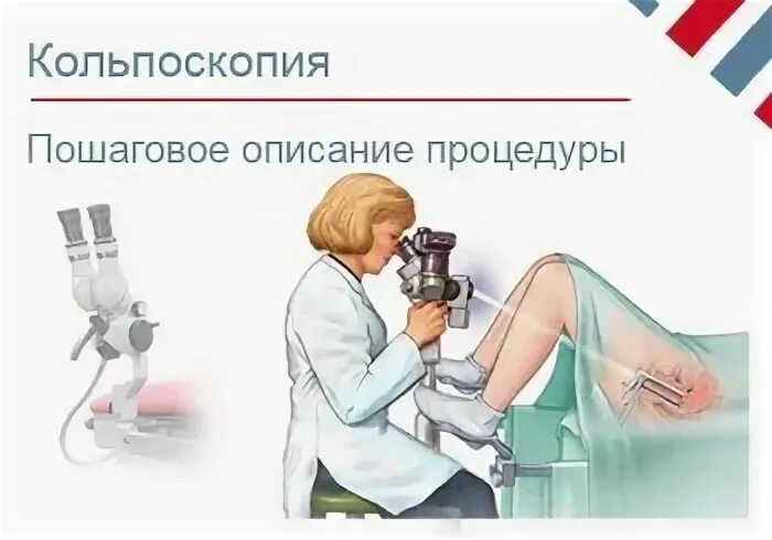 Кольпоскопия что это за процедура