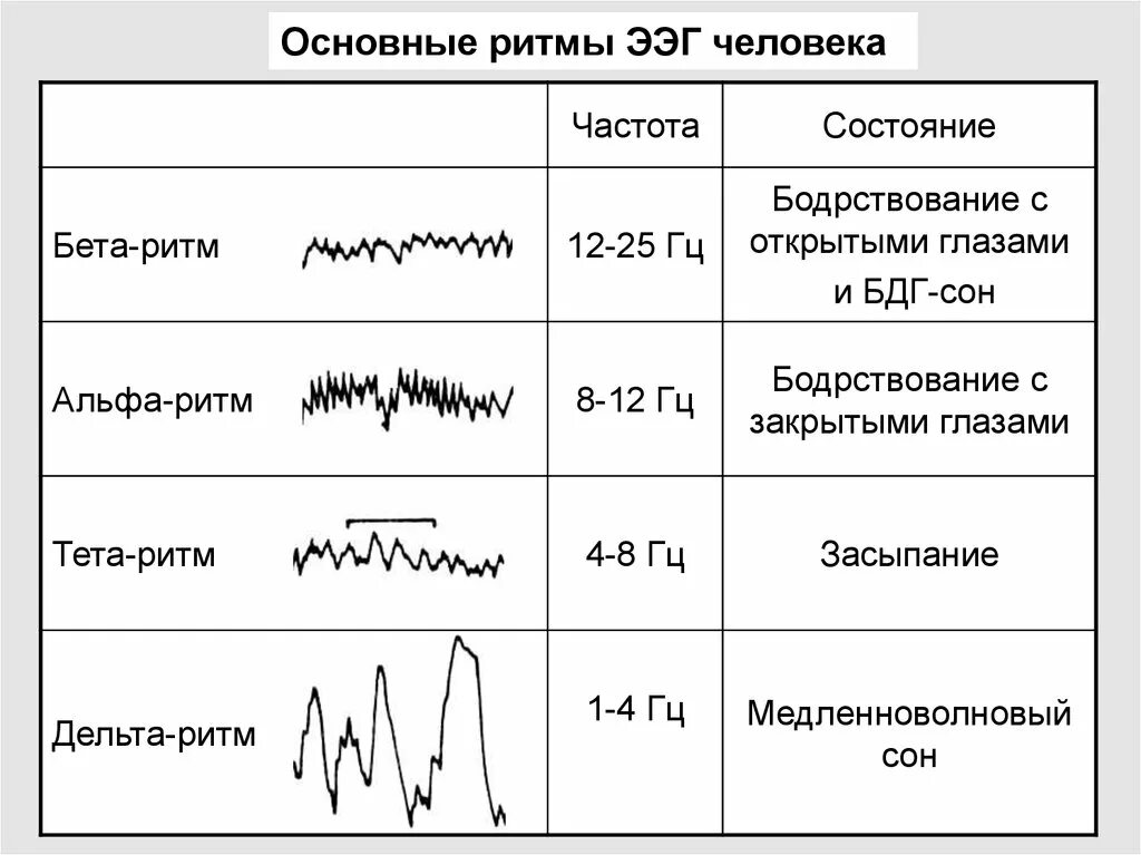 Ээг бодрствования. ЭЭГ головного мозга ритм Альфа ритм норма. Основные характеристики главных ритмов ЭЭГ.. ЭЭГ Альфа бета тета Дельта ритмы. Альфа ритм бета ритм тета ритм Дельта ритм ЭЭГ.