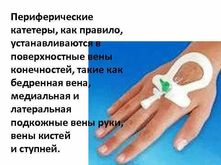 Алгоритм действия периферического катетера. Алгоритм действия периферического катетера
