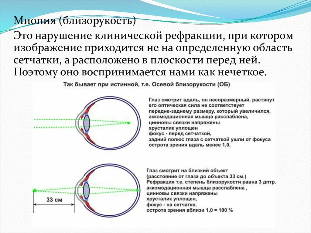 Миопия что это такое у детей. Классификация миопии осевая и рефракционная. Миопия осевая 1 степени. Осевая близорукость. Классификация близорукости.