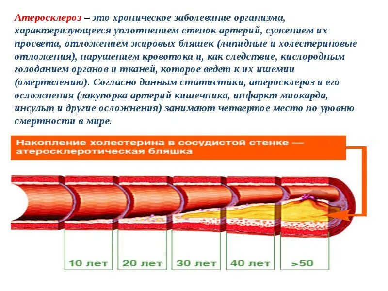 Чем характеризуются сосуды. Атеросклеротическая бляшка. Атеросклероз стенки артерии.