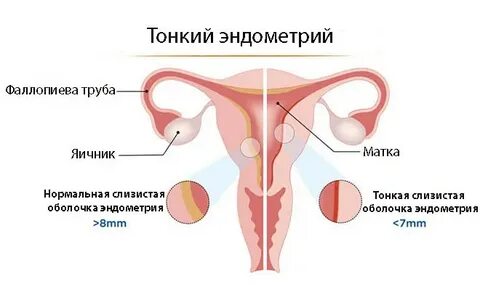 Эндометрий 4 мм форум