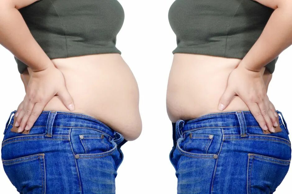 Похудение жир. Weight lose before after belly fat. Belly girl before and after Weight.