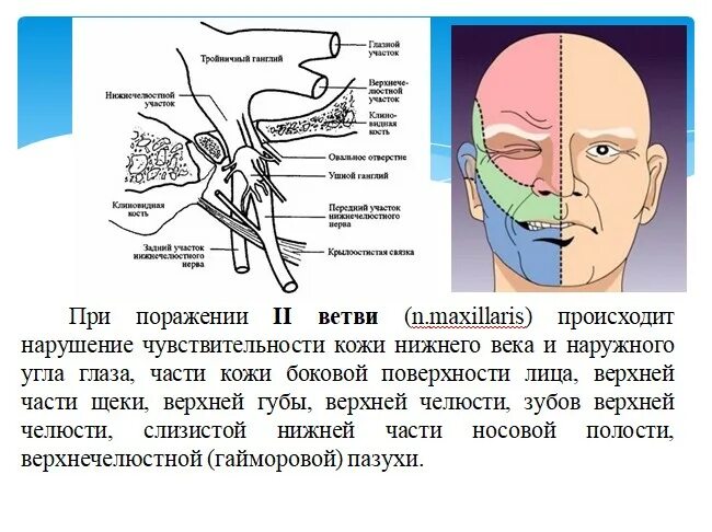 Поражение ветвей тройничного нерва. Симптомы поражения тройничного нерва неврология. Клинические признаки при поражении тройничного нерва. Тип нарушения чувствительности при невралгии тройничного нерва.