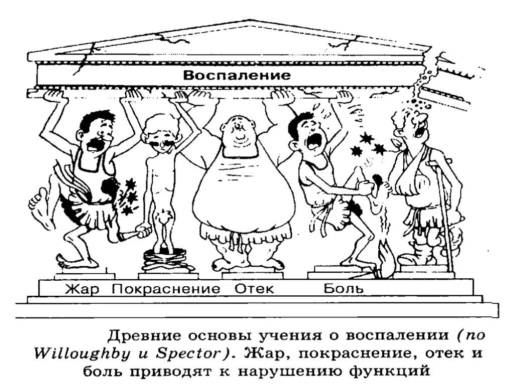 Признак воспаления dolor. Признаки воспаления схема. Местные признаки воспаления схема. Местное воспаление. Схема местных проявлений воспаления.