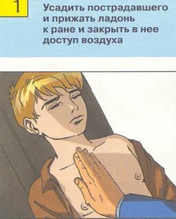 При кровотечении из раны головы прижимают