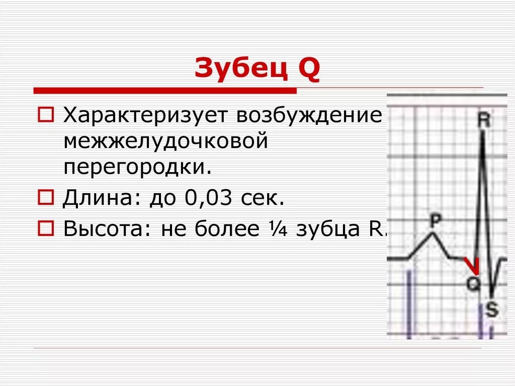 Изменение зубца q. Зубец q на ЭКГ В норме. Патологический зубец q на ЭКГ норма. ЭКГ зубец q норма и патология. ЭКГ зубец q в v2-v3 отведении.